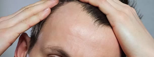 PRP for Hair Loss