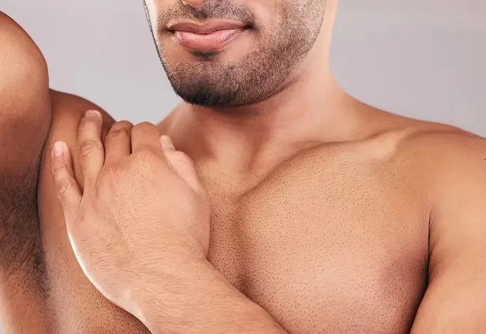 Botox for Excessive Sweating