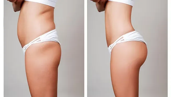 Bum Enhancement