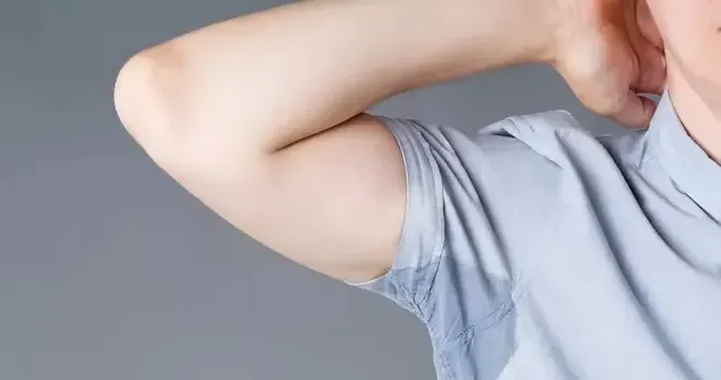 Hyperhidrosis