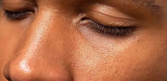 Diamond Microdermabrasion
