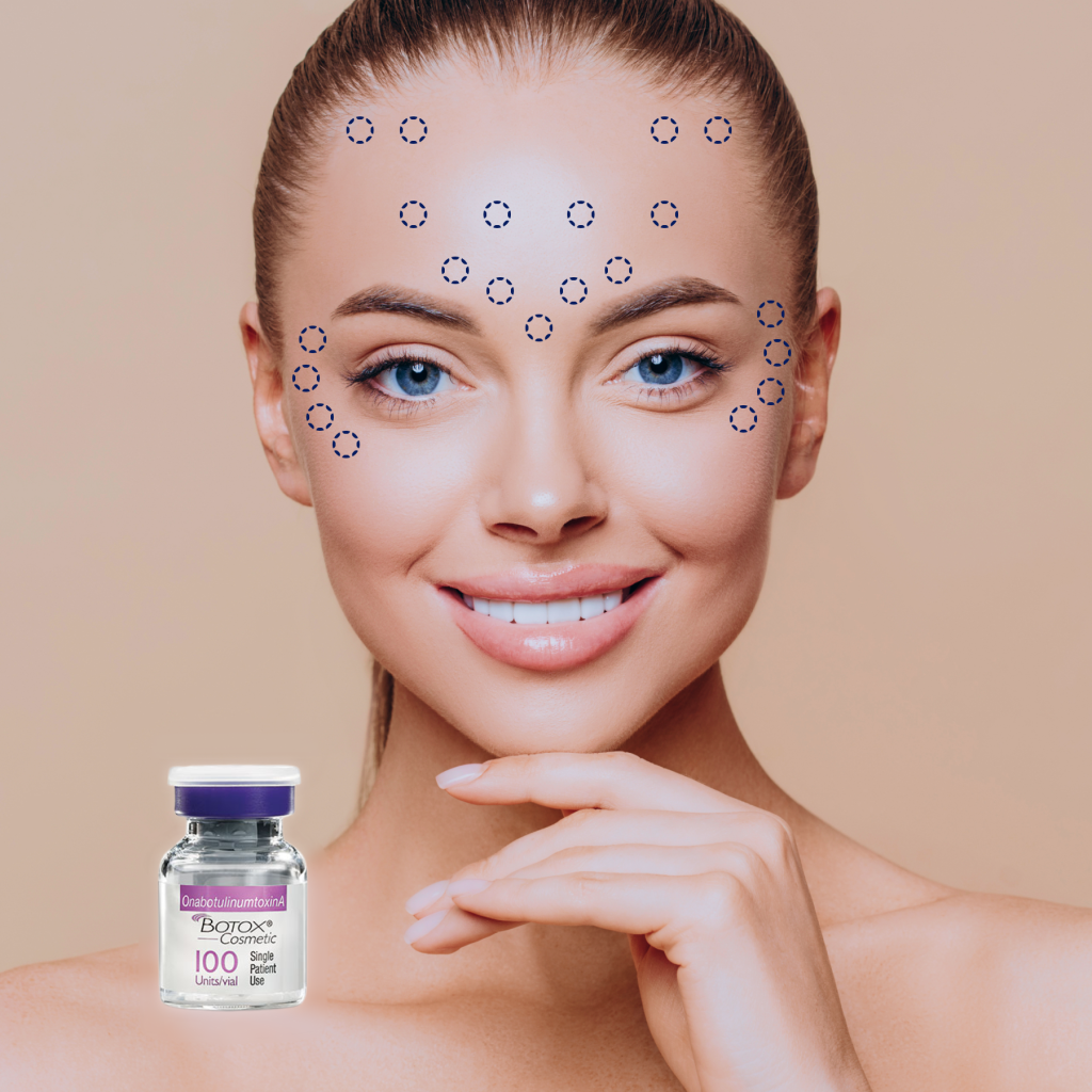 Anti-Wrinkle Injections 3 Areas