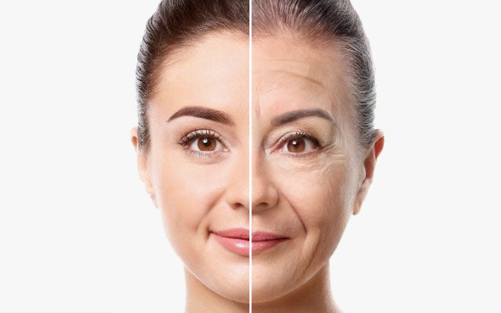 tirzepatide facial changes Mounjaro Face in London – How to Avoid Facial Ageing with Sculptra