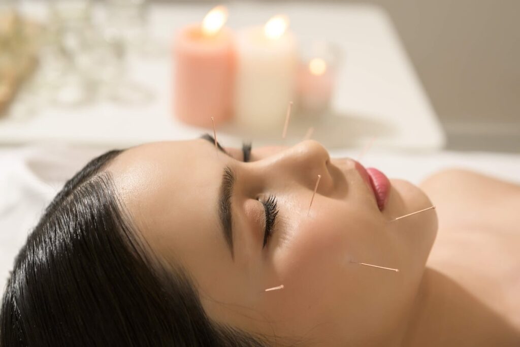 Cosmetic facial acupuncture treatment at Skinoza Clinic London