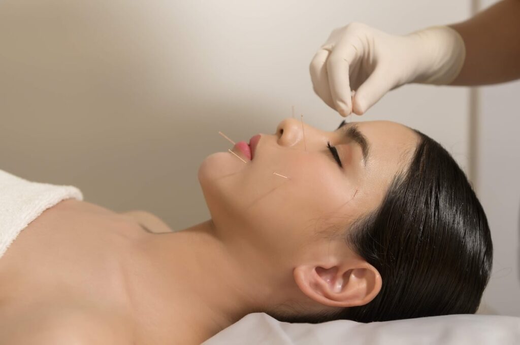 Results after cosmetic facial acupuncture sessions at Skinoza Clinic