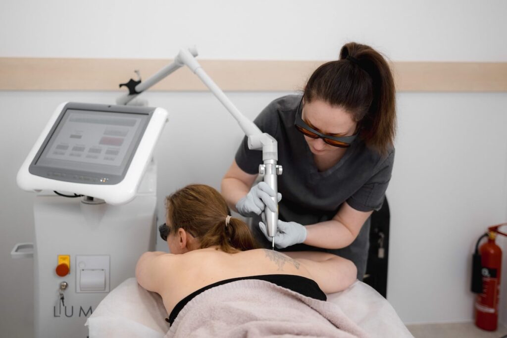 Laser tattoo removal session at Skinoza Clinic, London — qualified practitioner with protective goggles treating a back tattoo using a LUMI Q-switched laser