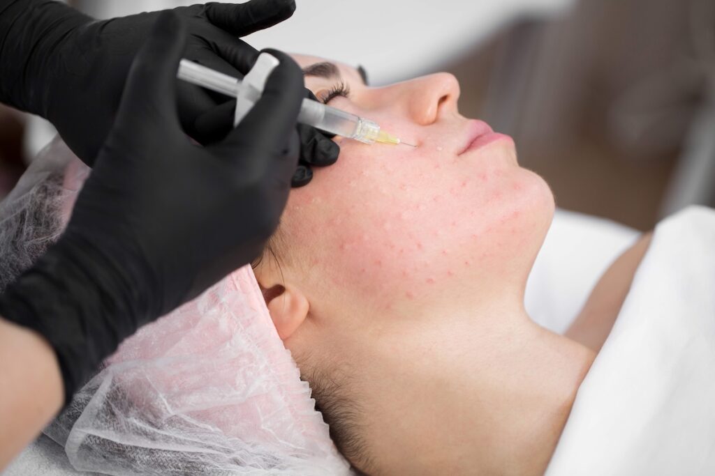 Rejuran Healer facial skin rejuvenation treatment in progress