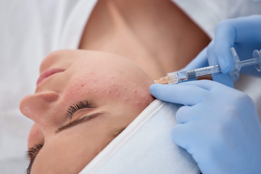 Rejuran skin rejuvenation injection treatment at Skinoza London clinic
